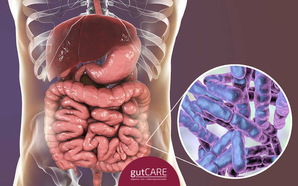 Constipation Treatment Singapore, Stomach Pain Symptoms