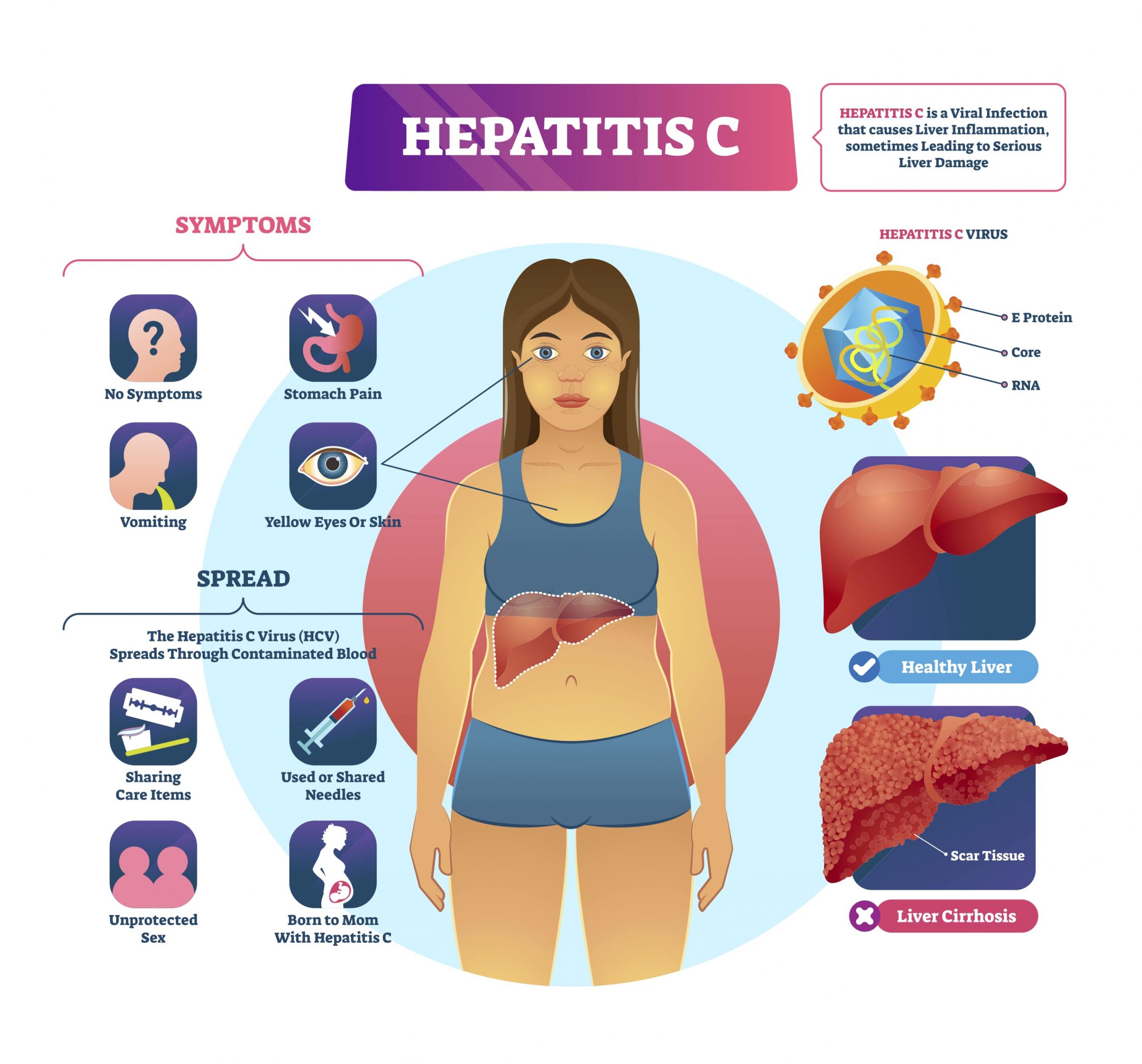 Hepatitis C GUTCARE