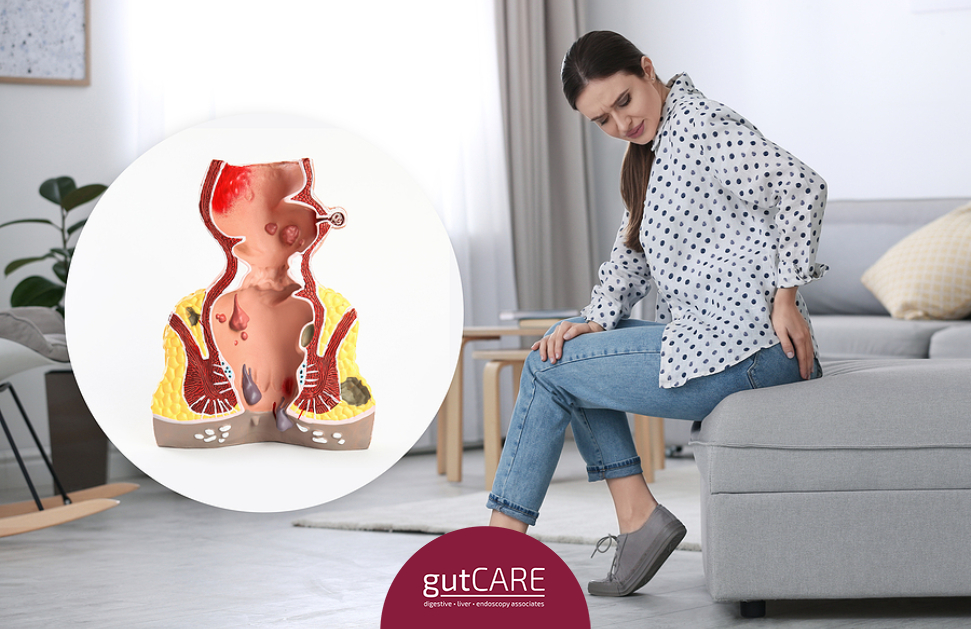The Six Common Causes Of Rectal Bleeding And Their Symptoms